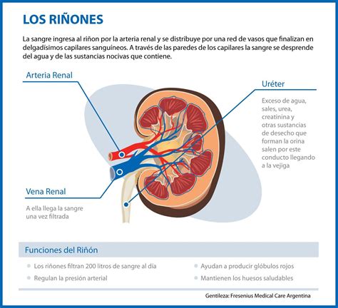 Infografía comparativa entre un riñón sano y un riñón con alteraciones estructurales