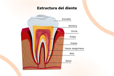 Esquema anatómico mostrando el esmalte desgastado y la exposición de la dentina
