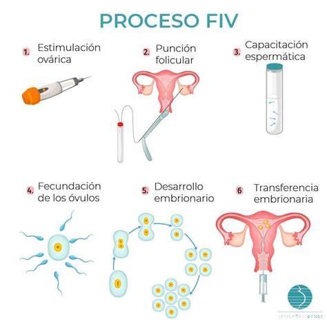 Esquema simplificado del proceso de Fecundación In Vitro (FIV)