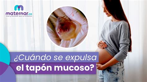 Esquema del cuello uterino con el tapón mucoso durante el embarazo