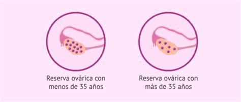 Gráfico de la disminución de la reserva ovárica con la edad