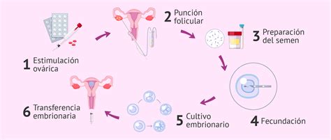 Esquema paso a paso del ciclo de FIV, desde la estimulación ovárica hasta la transferencia al útero.