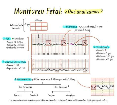 Esquema de un monitor fetal con transductores colocados en el abdomen de una mujer embarazada