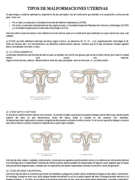 Ilustración comparativa de diferentes tipos de malformaciones uterinas