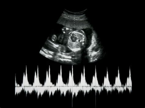 Ecografía fetal mostrando el latido del corazón en las primeras semanas de gestación