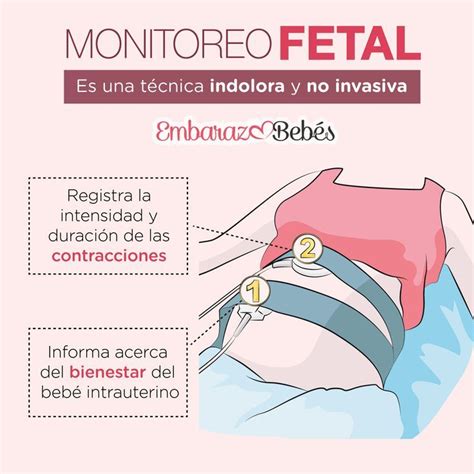 Ilustración de diferentes dispositivos de monitoreo fetal