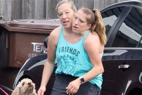 Ilustración de Abby y Brittany Hensel mostrando su unidad corporal