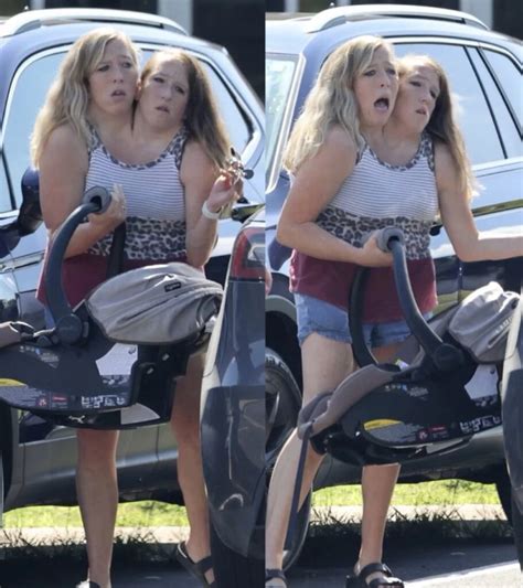 Fotografía de Abby y Brittany Hensel con un portabebés