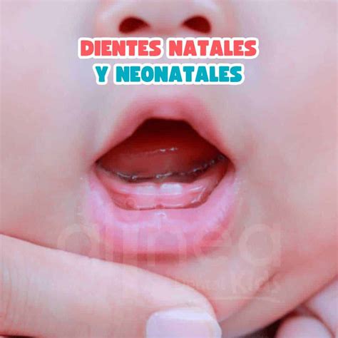 Esquema de las diferentes presentaciones de dientes natales y neonatales