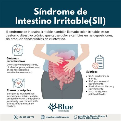 Infografía sobre el Síndrome del Intestino Irritable y sus síntomas principales en el tracto gastrointestinal.