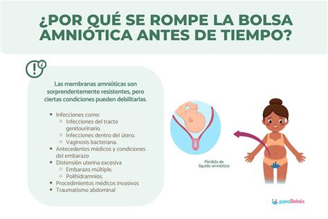 Diagrama de la bolsa amniótica y causas de su ruptura