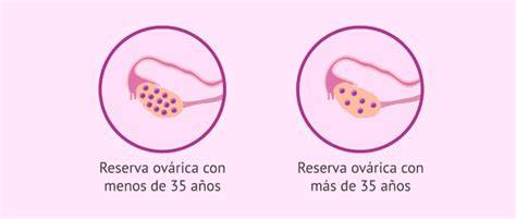 Gráfico comparativo que muestra el descenso de la reserva ovárica y la calidad de los óvulos conforme aumenta la edad de la mujer.