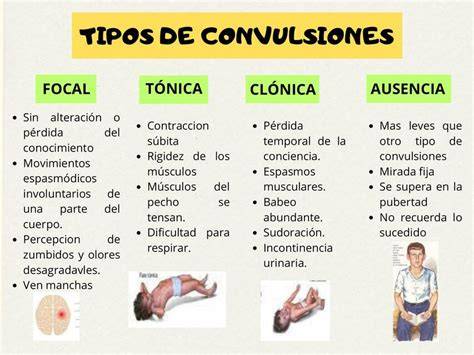 Tabla comparativa visual de los tipos de convulsiones infantiles y sus síntomas principales.