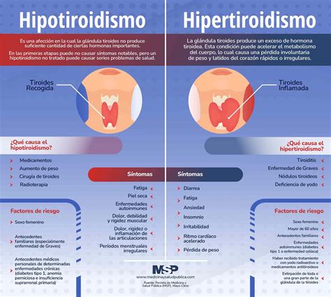 Infografía comparativa de síntomas: Hipertiroidismo vs Hipotiroidismo en el periodo posparto