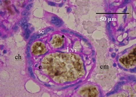 Microfotografía de vellosidades coriales mostrando la red capilar fetal y el contacto con la sangre materna.