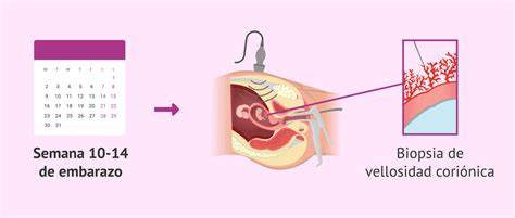 Representación esquemática de la amniocentesis y la biopsia de vellosidades coriónicas