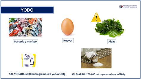 Infografía comparativa: fuentes de yodo en la dieta vs. necesidad de suplementación según el perfil de la madre.
