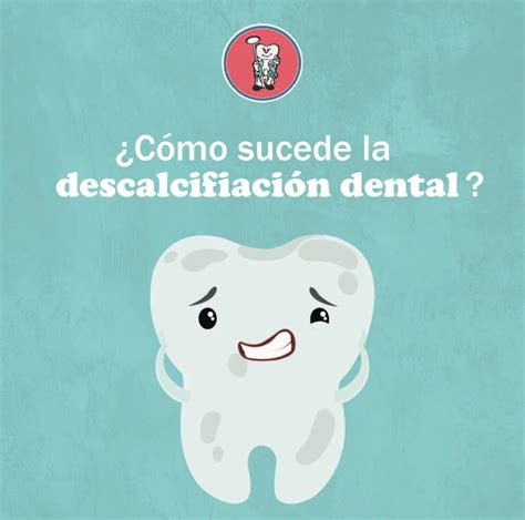 Infografía mostrando las principales causas de descalcificación dental