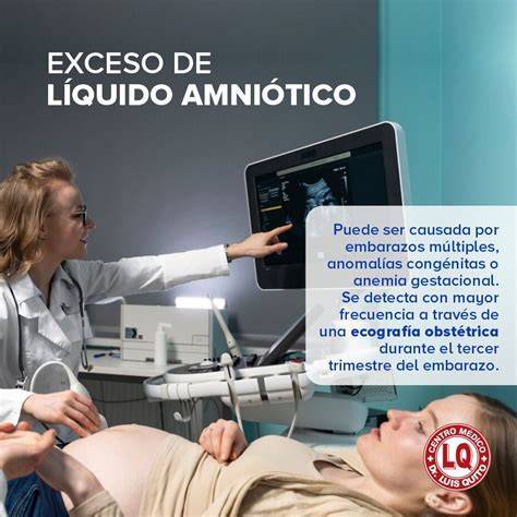 Ecografía mostrando una condición de polihidramnios con exceso de líquido amniótico