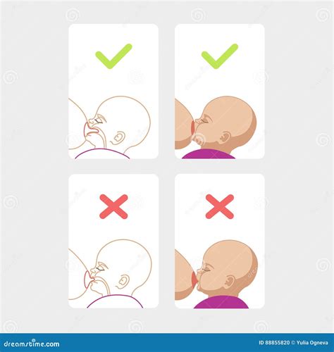 Ilustración mostrando una correcta y una incorrecta posición del bebé al pecho, resaltando el agarre adecuado.