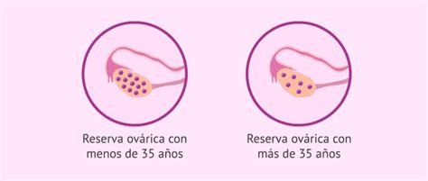 Esquema de la disminución de la reserva ovárica y la calidad de los óvulos con la edad