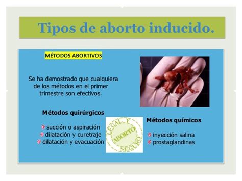 Infografía comparativa de los diferentes métodos de aborto inducido: médico y quirúrgico.