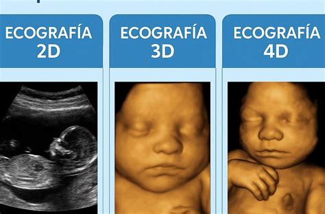 Esquema comparativo de las diferentes modalidades de ecografía fetal (2D, 3D, 4D, Doppler)