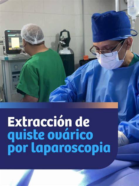 Ilustración de una laparotomía para la extracción de un quiste ovárico de gran tamaño