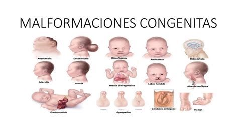Esquema de las principales causas de malformaciones congénitas