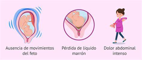 Ilustración de las principales causas de muerte fetal intrauterina