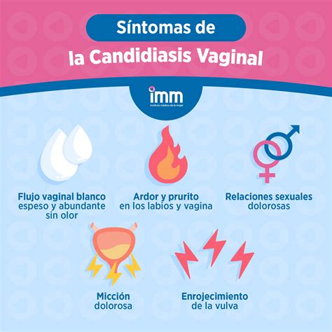 Ilustración de la vulva mostrando enrojecimiento e hinchazón, síntomas de candidiasis.