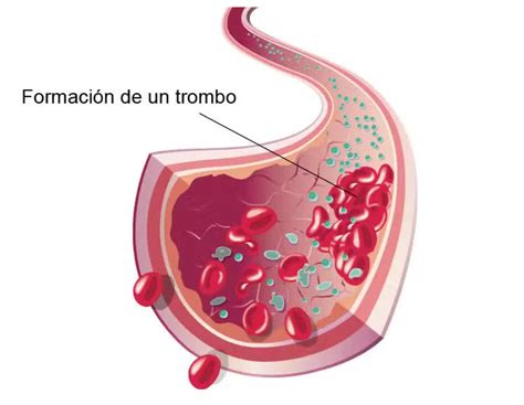 Esquema fisiológico de la hipercoagulabilidad en el embarazo: equilibrio entre la prevención de hemorragias en el parto y el riesgo aumentado de trombosis venosa.