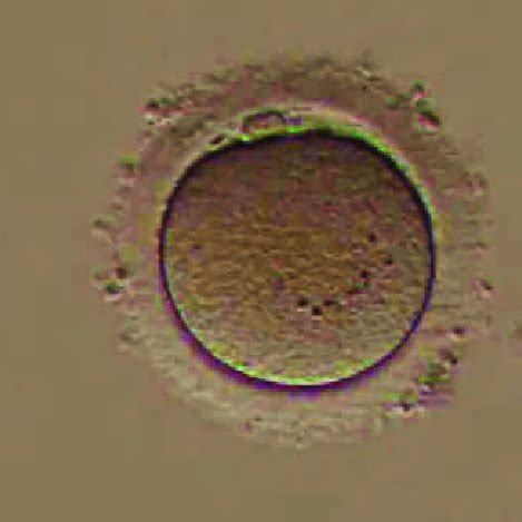 imagen de un ovocito bajo microscopio, con una superposición gráfica que ilustra la influencia del cortisol en su maduración.