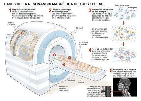 Esquema explicativo de la tecnología de resonancia magnética: campos magnéticos y radiofrecuencia