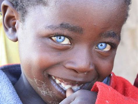 Fotografía de un niño con ojos de color zafiro en Zimbawe.