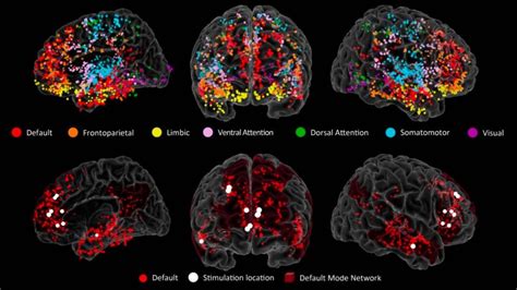Gráfico mostrando la actividad cerebral fetal en respuesta a sonidos
