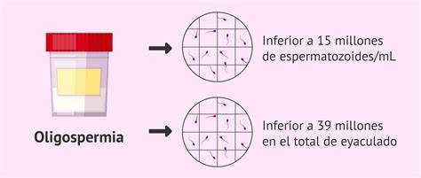 Gráfico mostrando la disminución de la concentración espermática en las últimas décadas