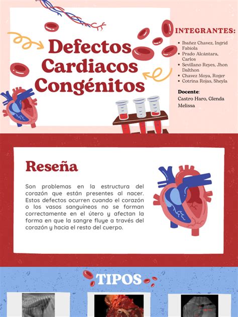 Ilustración de un corazón con defectos congénitos comunes.