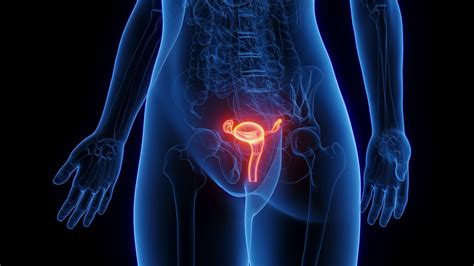 Ilustración médica mostrando un útero con un embarazo detenido y sin actividad cardíaca fetal.