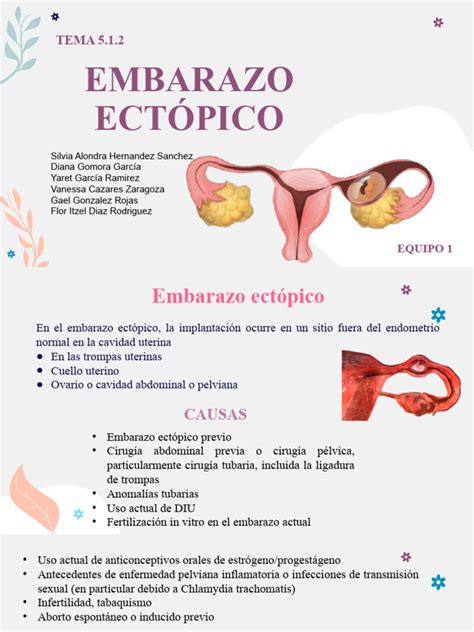 Diagrama de embarazo ectópico en comparación con embarazo intrauterino