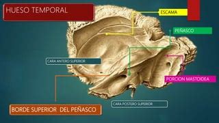Corte del hueso temporal mostrando la escama, el peñasco y la apófisis mastoides
