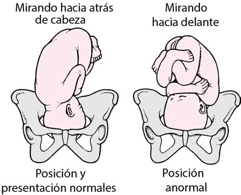Ilustración comparando la posición del bebé en una silla con y sin la reclinación adecuada