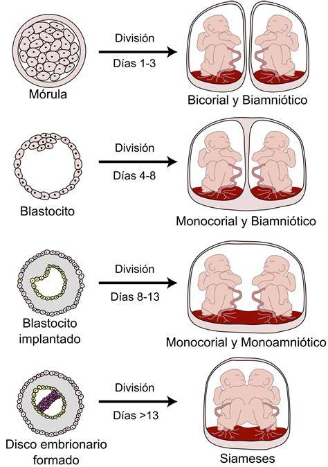 Diagrama de tipos de embarazos gemelares (monocoriales y bicoriales)