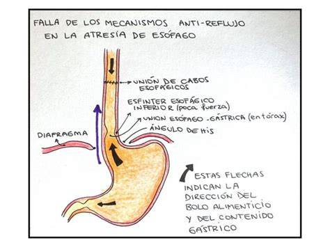 Infografía que detalla los ingredientes clave y su función en la leche antirreflujo