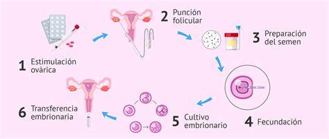 Esquema explicativo del proceso de fecundación in vitro con ovodonación, mostrando la donación del óvulo, la fecundación en laboratorio y la transferencia embrionaria.