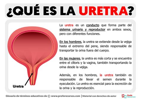 Esquema anatómico del pene y la uretra, mostrando las diferentes ubicaciones del meato uretral en el hipospadias.