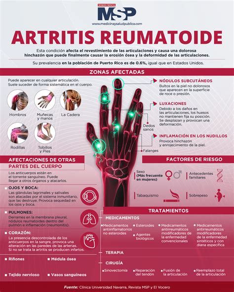 Infografía sobre la artritis reumatoide y sus efectos