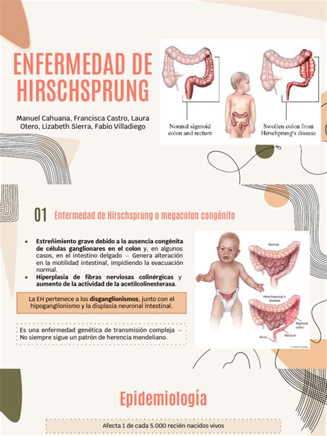 Esquema de la enfermedad de Hirschsprung en el colon del bebé