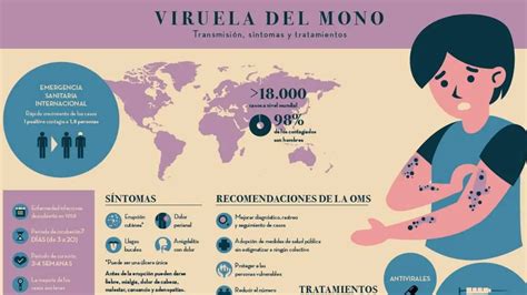Infografía: Distribución de casos de viruela del mono por edad en España