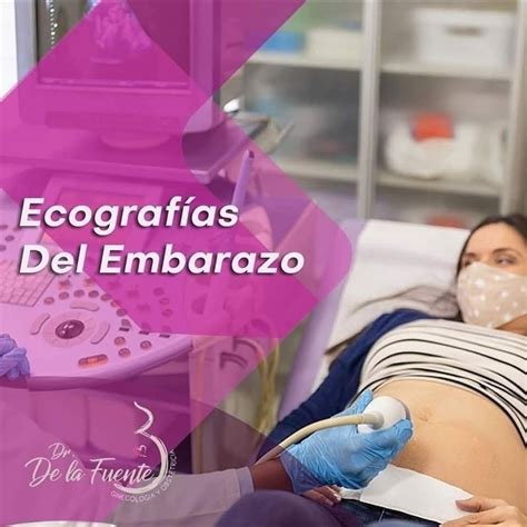 Esquema que muestra la posición del transductor sobre el abdomen materno para visualizar el saco gestacional y el embrión.
